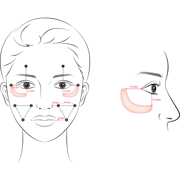 Gouri Kollagen Filler