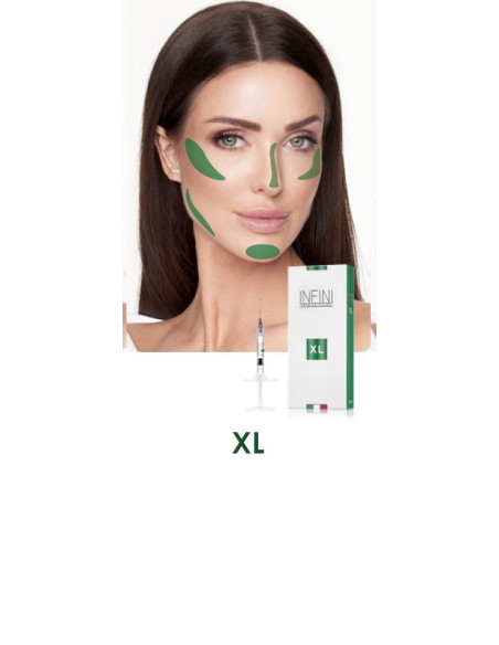 Hyaluron Spritze zur Faltenunterpriztung Dermal Filler mit Hyaluronsäure Volumenaufbau