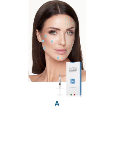 Neue Hyaluronsäure Spritze zur Hydration und Auffrischung