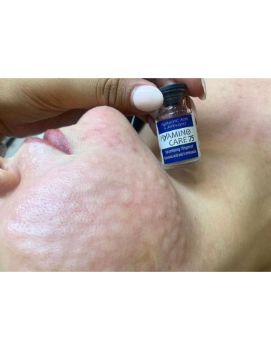 HyAMINO CARE 75  5 ml Ampulle 75 mg Hyaluronsäure + 4 Aminosäuren