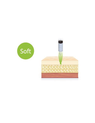 Cara Lidocaine Filler  ✅| neuer quervernetzter HA-Weichteilfiller