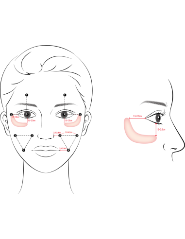 Gouri Kollagen Filler