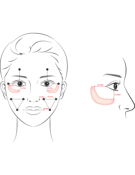 Gouri Kollagen Filler